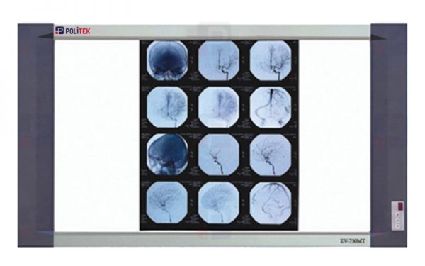 Double Section Led Negatoscope