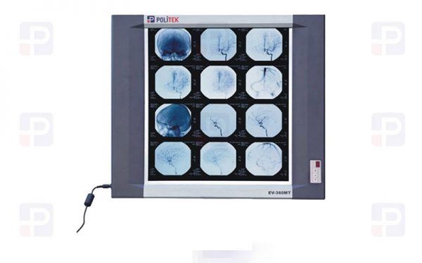 Single Section Led Negatoscope